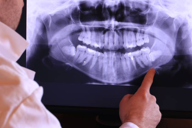 Best Emergency Root Canal Treatment in Smithville, NJ