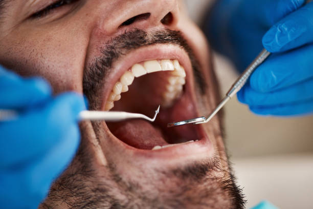 Best Emergency Tooth Extraction in Smithville, NJ