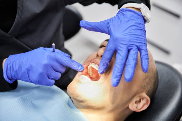 Best Emergency Treatment for Dental Infections or Abscesses in Smithville, NJ